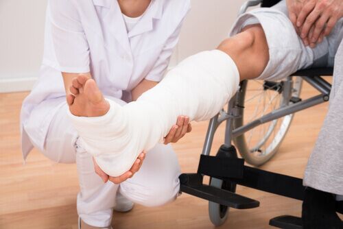 person with broken bone in leg